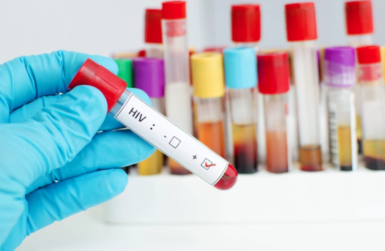 BREAKTHROUGH: ‘New York Patient’ Becomes First Woman to be ‘Cured of HIV’￼