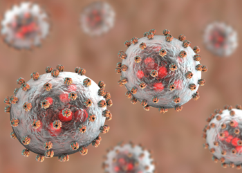 SITUATION UPDATE ON AN IMPORTED CASE OF LASSA FEVER FROM NIGERIA TO SOUTH AFRICA