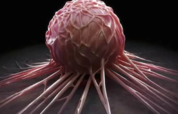 Breakthrough for cancer treatment as US drug trial records ‘100% success’